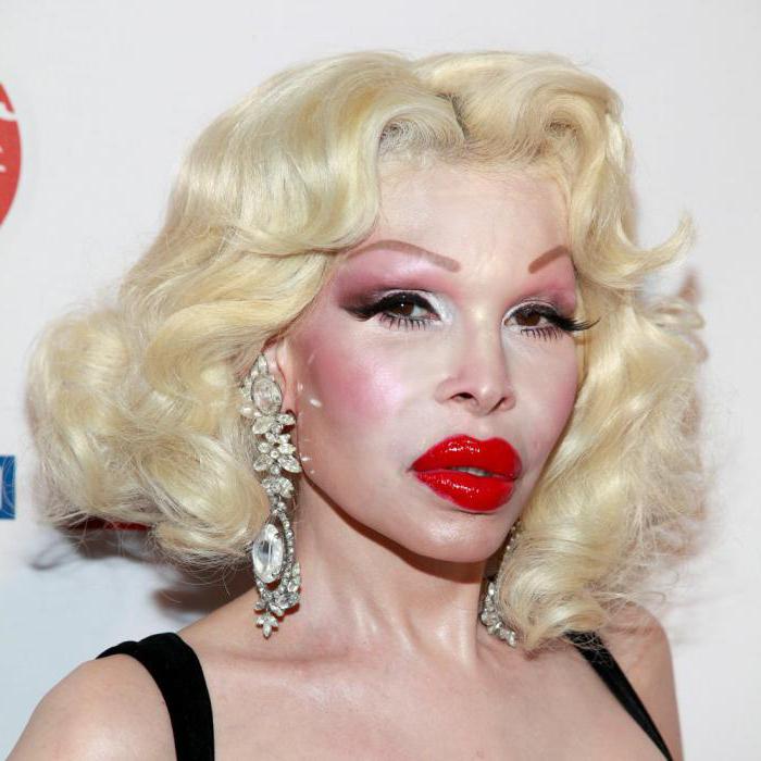 Amanda Lepore: מודל החיים לפני ואחרי הניתוח